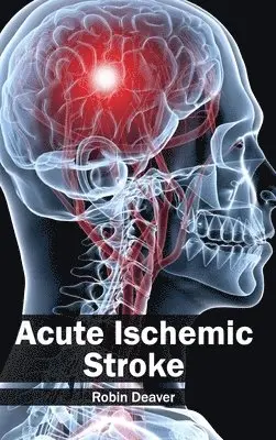 Robin Deaver - Acute Ischemic Stroke, Inbunden. Tillgänglighet: Lägg i varukorg
