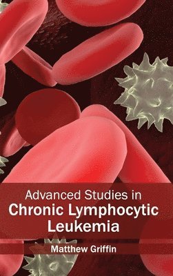 Matthew Griffin - Advanced Studies in Chronic Lymphocytic Leukemia, Inbunden