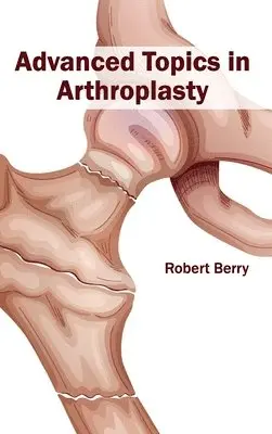Robert Berry - Advanced Topics in Arthroplasty, Inbunden. Tillgänglighet: Lägg i varukorg