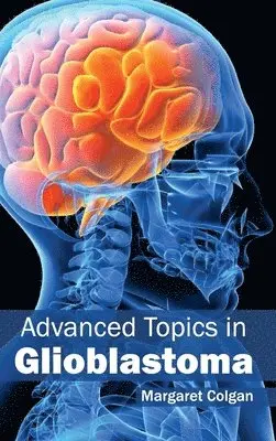 Margaret Colgan - Advanced Topics in Glioblastoma, Inbunden. Tillgänglighet: Lägg i varukorg