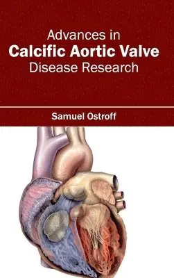 Samuel Ostroff - Advances in Calcific Aortic Valve Disease Research, Inbunden. Tillgänglighet: Lägg i varukorg