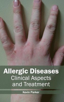 Kevin Parker - Allergic Diseases: Clinical Aspects and Treatment, Inbunden