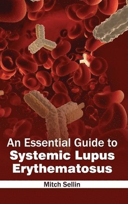 Mitch Sellin - Essential Guide to Systemic Lupus Erythematosus, Inbunden