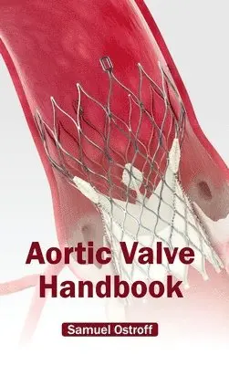Samuel Ostroff - Aortic Valve Handbook, Inbunden. Tillgänglighet: Lägg i varukorg