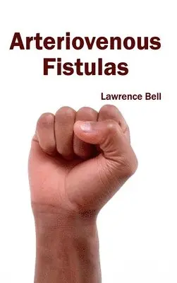 Lawrence Bell - Arteriovenous Fistulas, Inbunden. Tillgänglighet: Lägg i varukorg