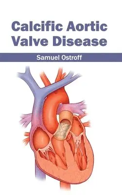 Samuel Ostroff - Calcific Aortic Valve Disease, Inbunden. Tillgänglighet: Lägg i varukorg