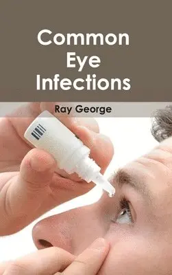 Ray George - Common Eye Infections, Inbunden. Tillgänglighet: Lägg i varukorg