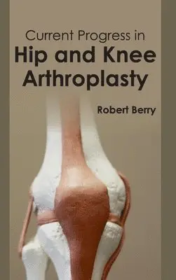 Robert Berry - Current Progress in Hip and Knee Arthroplasty, Inbunden. Tillgänglighet: Lägg i varukorg