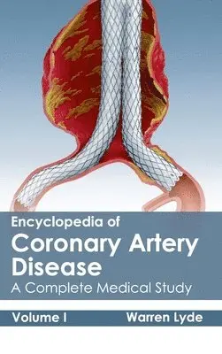Warren Lyde - Encyclopedia of Coronary Artery Disease: Volume I (a Complete Medical Study), Inbunden. Tillgänglighet: Lägg i varukorg