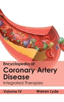 Warren Lyde - Encyclopedia of Coronary Artery Disease: Volume IV (Integrated Therapies), Inbunden. Tillgänglighet: Lägg i varukorg