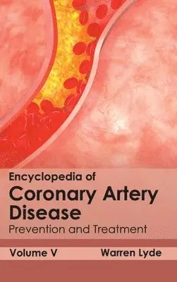 Warren Lyde - Encyclopedia of Coronary Artery Disease: Volume V (Prevention and Treatment), Inbunden. Tillgänglighet: Lägg i varukorg