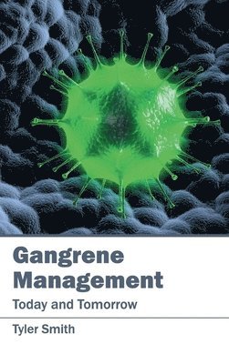 Tyler Smith - Gangrene Management: Today and Tomorrow, Inbunden