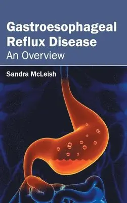Sandra McLeish - Gastroesophageal Reflux Disease: An Overview, Inbunden. Tillgänglighet: Lägg i varukorg