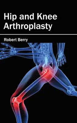Robert Berry - Hip and Knee Arthroplasty, Inbunden. Tillgänglighet: Lägg i varukorg