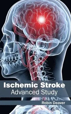 Robin Deaver - Ischemic Stroke: Advanced Study, Inbunden. Tillgänglighet: Lägg i varukorg