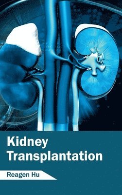 Reagen Hu - Kidney Transplantation, Inbunden. Tillgänglighet: Lägg i varukorg