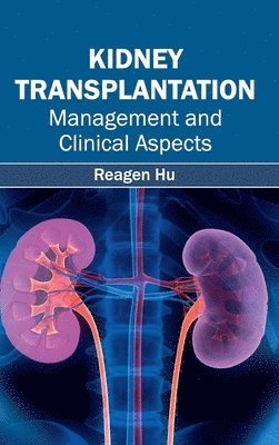 Reagen Hu - Kidney Transplantation: Management and Clinical Aspects, Inbunden. Tillgänglighet: Lägg i varukorg