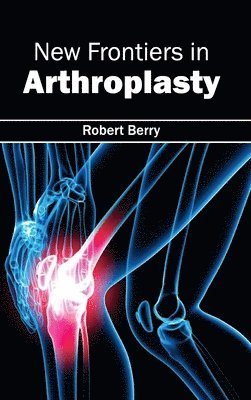 Robert Berry - New Frontiers in Arthroplasty, Inbunden. Tillgänglighet: Lägg i varukorg