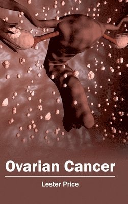 Lester Price - Ovarian Cancer, Inbunden