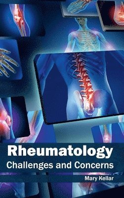 Rheumatology: Challenges and Concerns