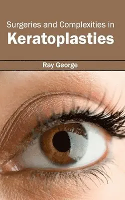 Ray George - Surgeries and Complexities in Keratoplasties, Inbunden. Tillgänglighet: Lägg i varukorg
