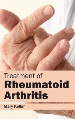 Mary Kellar - Treatment of Rheumatoid Arthritis, Inbunden. Tillgänglighet: Lägg i varukorg
