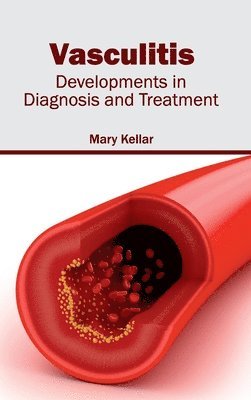 Mary Kellar - Vasculitis: Developments in Diagnosis and Treatment, Inbunden. Tillgänglighet: Lägg i varukorg