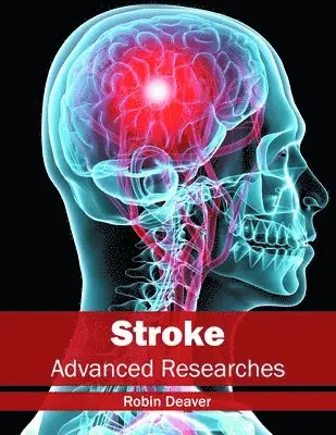 Robin Deaver - Stroke: Advanced Researches, Inbunden. Tillgänglighet: Lägg i varukorg