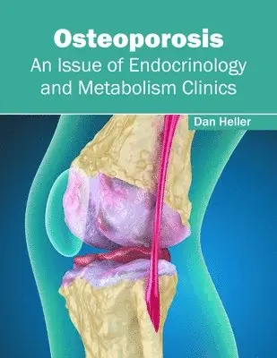 Dan Heller - Osteoporosis: An Issue of Endocrinology and Metabolism Clinics, Inbunden. Tillgänglighet: Kommande