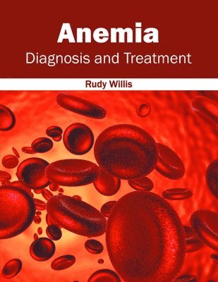 Anemia: Diagnosis and Treatment