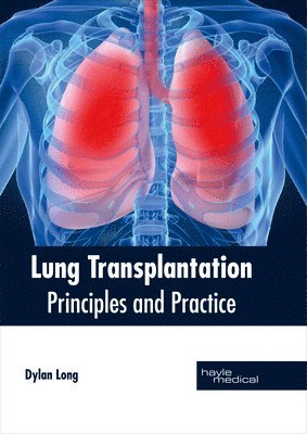 Dylan Long - Lung Transplantation: Principles and Practice, Inbunden. Tillgänglighet: Lägg i varukorg
