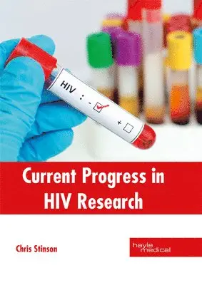 Chris Stinson - Current Progress in HIV Research, Inbunden. Tillgänglighet: Lägg i varukorg