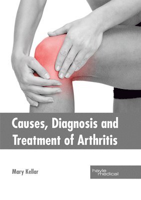 Mary Kellar - Causes, Diagnosis and Treatment of Arthritis, Inbunden. Tillgänglighet: Lägg i varukorg