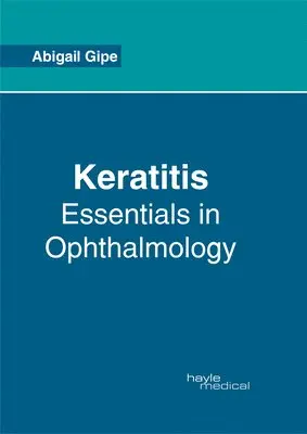 Abigail Gipe - Keratitis: Essentials in Ophthalmology, Inbunden. Tillgänglighet: Lägg i varukorg