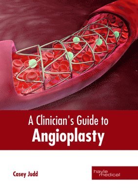 Casey Judd - Clinician's Guide to Angioplasty, Inbunden. Tillgänglighet: Lägg i varukorg