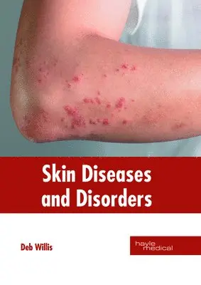 Deb Willis - Skin Diseases and Disorders, Inbunden. Tillgänglighet: Lägg i varukorg