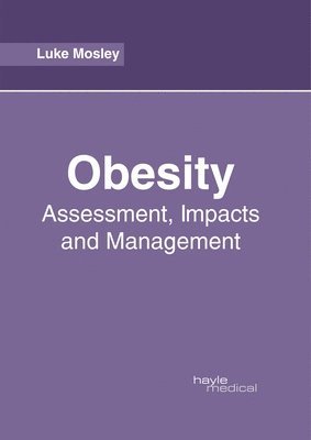 Luke Mosley - Obesity: Assessment, Impacts and Management, Inbunden