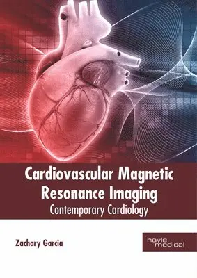 Zachary Garcia - Cardiovascular Magnetic Resonance Imaging: Contemporary Cardiology, Inbunden. Tillgänglighet: Lägg i varukorg