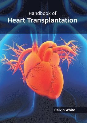Calvin White - Handbook of Heart Transplantation, Inbunden