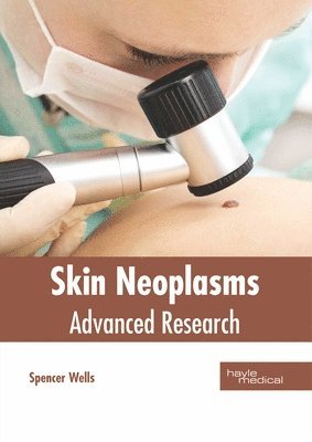 Spencer Wells - Skin Neoplasms: Advanced Research, Inbunden. Tillgänglighet: Lägg i varukorg