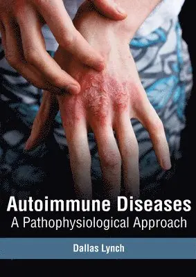 Dallas Lynch - Autoimmune Diseases: A Pathophysiological Approach, Inbunden. Tillgänglighet: Lägg i varukorg