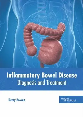 Remy Bowen - Inflammatory Bowel Disease: Diagnosis and Treatment, Inbunden. Tillgänglighet: Lägg i varukorg