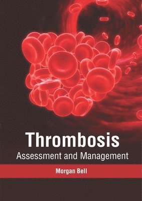 Morgan Bell - Thrombosis: Assessment and Management, Inbunden. Tillgänglighet: Lägg i varukorg