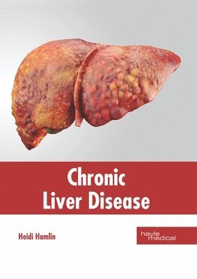 Heidi Hamlin - Chronic Liver Disease, Inbunden. Tillgänglighet: Lägg i varukorg