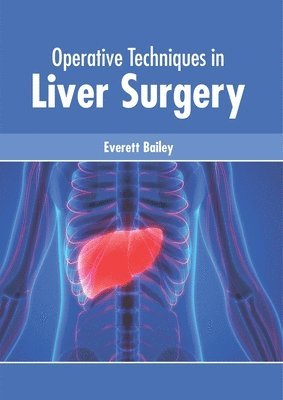 Operative Techniques in Liver Surgery