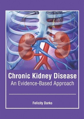 Felicity Darko - Chronic Kidney Disease: An Evidence-Based Approach, Inbunden. Tillgänglighet: Lägg i varukorg