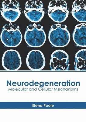 Elena Poole - Neurodegeneration: Molecular and Cellular Mechanisms, Inbunden. Tillgänglighet: Lägg i varukorg