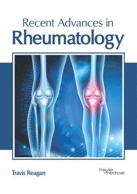 Travis Reagan - Recent Advances in Rheumatology, Inbunden. Tillgänglighet: Lägg i varukorg