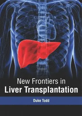 Duke Todd - New Frontiers in Liver Transplantation, Inbunden. Tillgänglighet: Lägg i varukorg