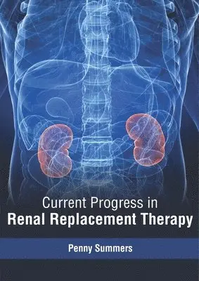 Penny Summers - Current Progress in Renal Replacement Therapy, Inbunden. Tillgänglighet: Lägg i varukorg